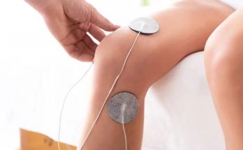 What to Expect During Your First Appointment at a Physiotherapy Clinic